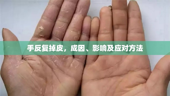 手反复掉皮,成因、影响及应对方法